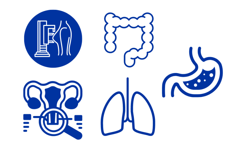 ECO Celebrates a New Era in EU Cancer Screening Policy